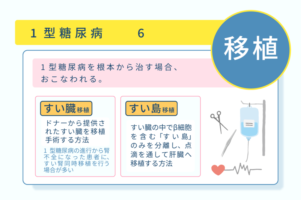 １型糖尿病を根本から治す場合移植が行われる