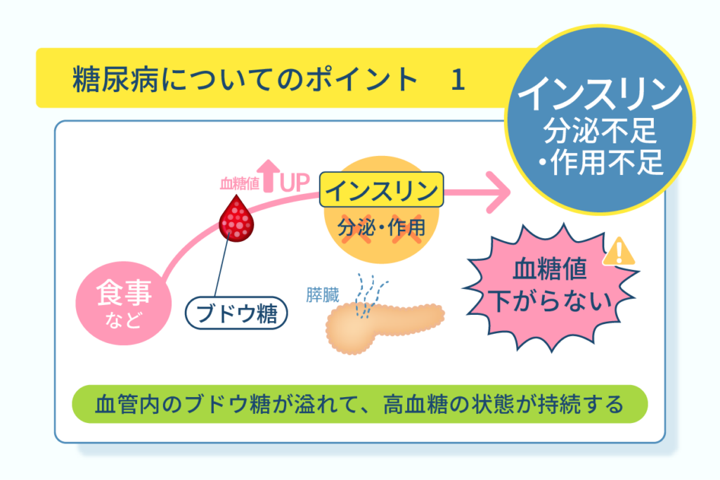 糖尿病についてのポイント１インスリン分泌不足・作用不足