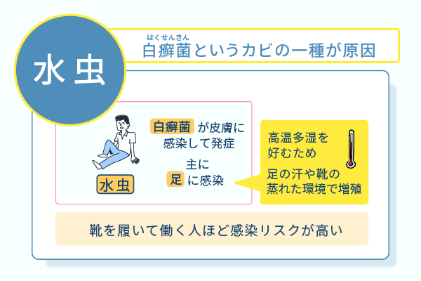 水虫は白癬菌というカビの一種が原因