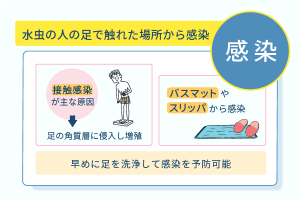 水虫の人の足で触れた場所から感染