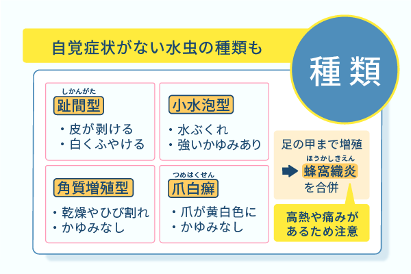 自覚症状がない水虫の種類も