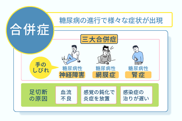 糖尿病の進行で様々な症状が出現