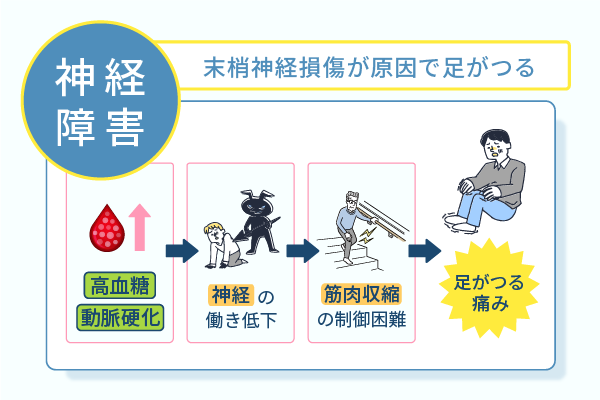 末梢神経損傷が原因で足がつる