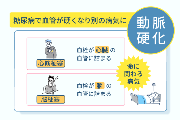 糖尿病で血管が硬くなり別の病気に