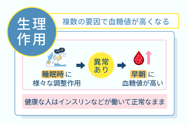 複数の要因で血糖値が高くなる