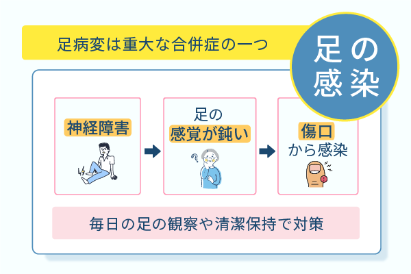 足病変は重大な合併症の一つ