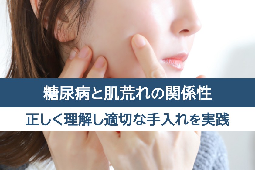 糖尿病と肌荒れの関係性。正しく理解し適切な手入れを実践