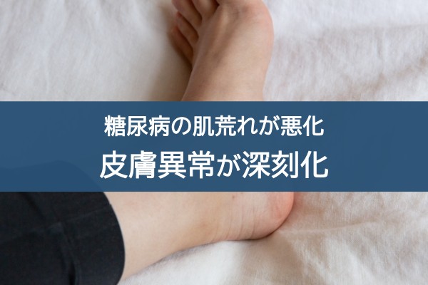 糖尿病の肌荒れが悪化。皮膚異常が深刻化