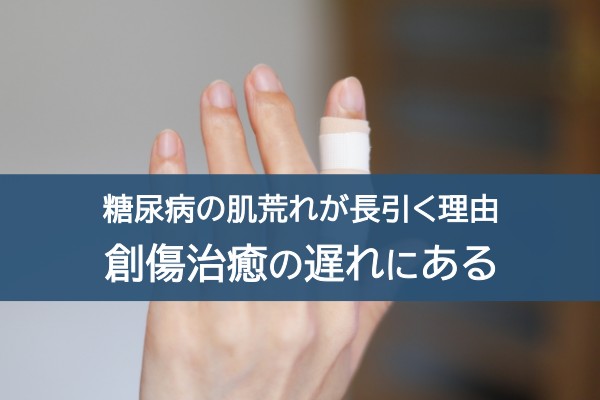糖尿病の肌荒れが長引く理由。創傷治癒の遅れにある