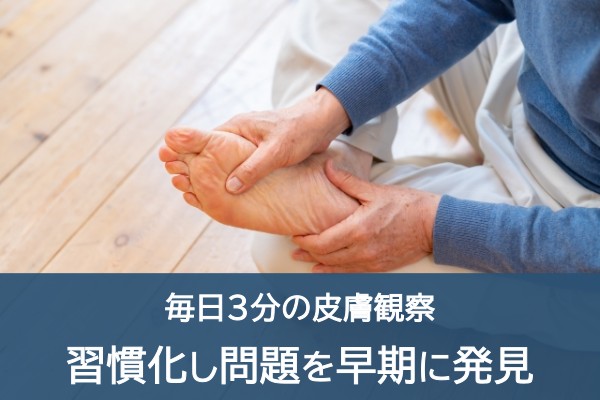 毎日3分の皮膚観察。習慣化し問題を早期に発見
