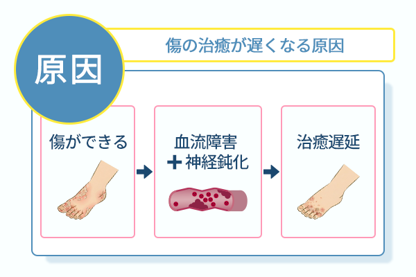 傷の治療が遅くなる原因