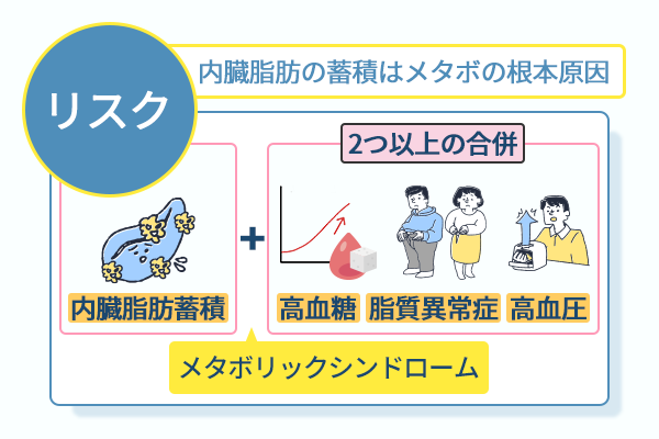 内臓脂肪の蓄積はメタボの根本原因