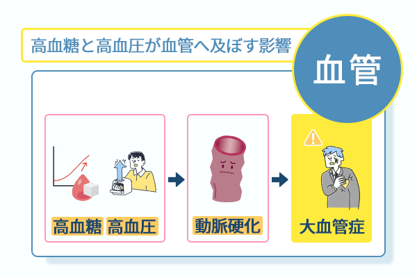 高血糖と高血圧が血管へ及ぼす影響